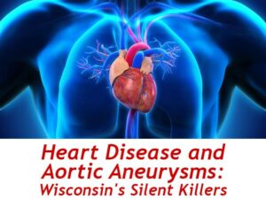 Heart Disease and Aortic Aneurysms: Tuesday, Sept 26th at Noon